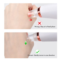 Load image into Gallery viewer, Electric Blackhead Suction Removal Beauty Tool