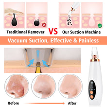 Load image into Gallery viewer, Electric Blackhead Suction Removal Beauty Tool